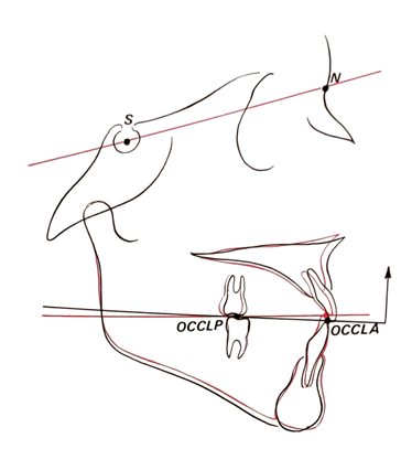 Tracciato cefalometrico 1