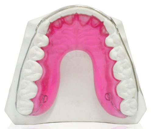 Contenzioen Superiore