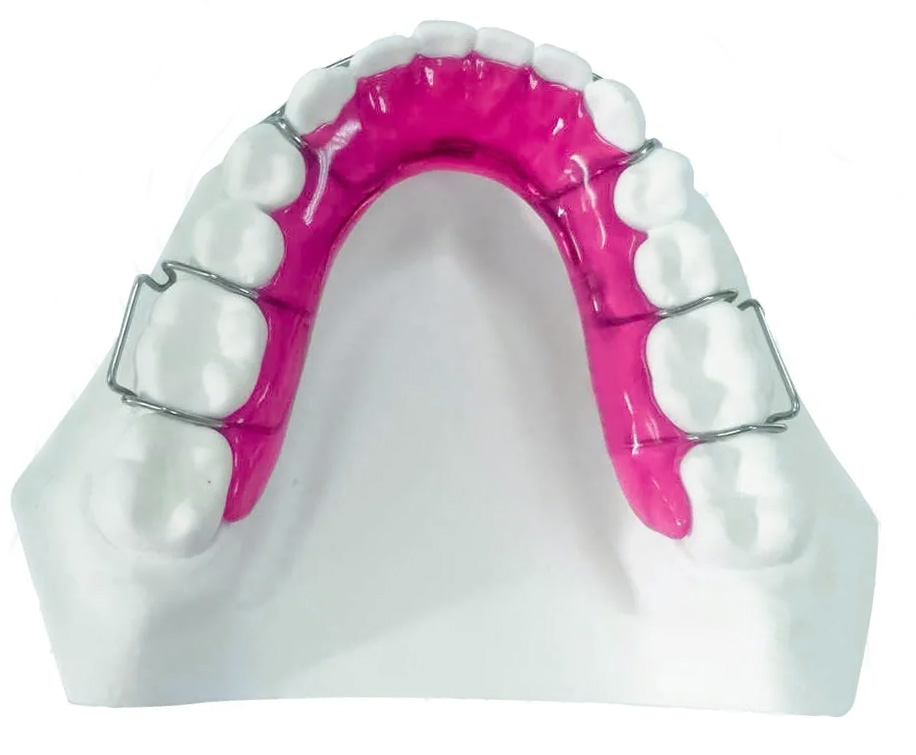 Contenzione Inferiore